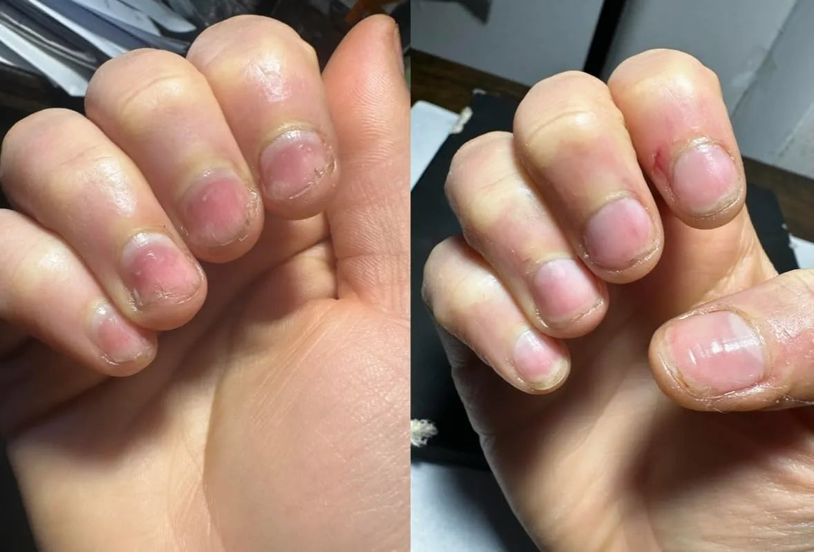 Nailix™ Nagelwachstums-Stift mit Stammzellen