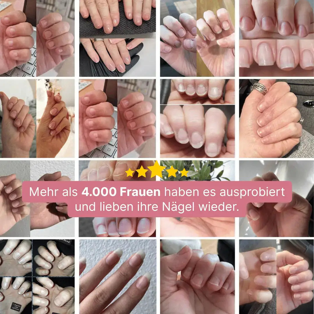 Nailix™ Nagelwachstums-Stift mit Stammzellen