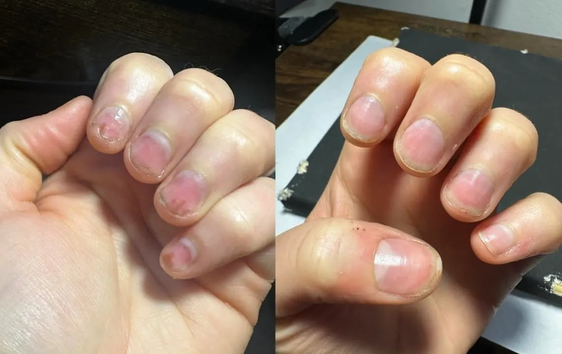 Nailix™ Nagelwachstums-Stift mit Stammzellen