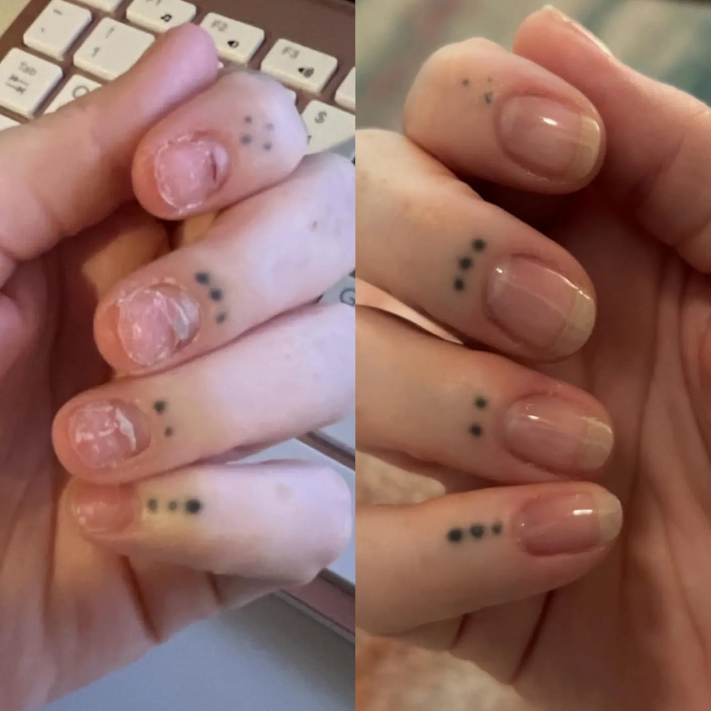 Nailix™ Nagelwachstums-Stift mit Stammzellen