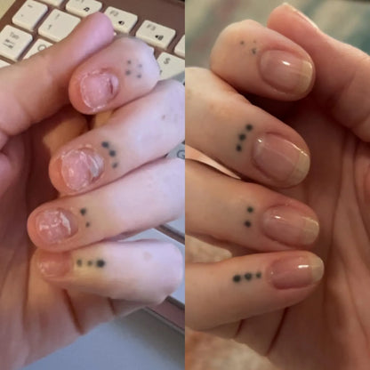 Nailix™ Nagelwachstums-Stift mit Stammzellen