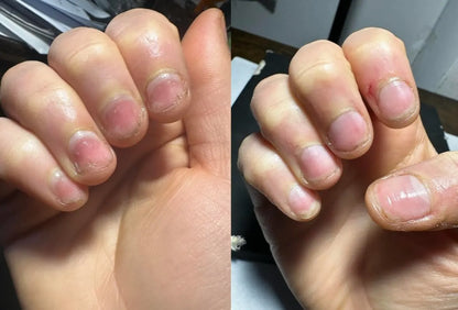 Nailix™ Nagelwachstums-Stift mit Stammzellen